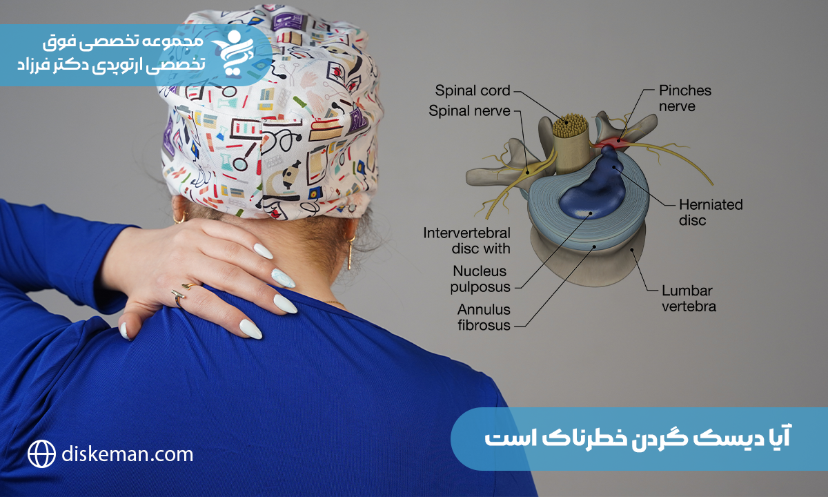 آیا دیسک گردن خوب میشود، درمان خوراکی، دارویی و فیزوتراپی